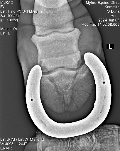 Luna Radiographs0003